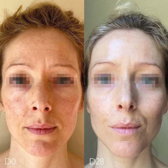 CAUDALIE Vinoperfect Serum Mehr Ausstrahlung 30 Ml 6 CAUDALIE Vinoperfect Serum Mehr Ausstrahlung 30 Ml – Bild 4